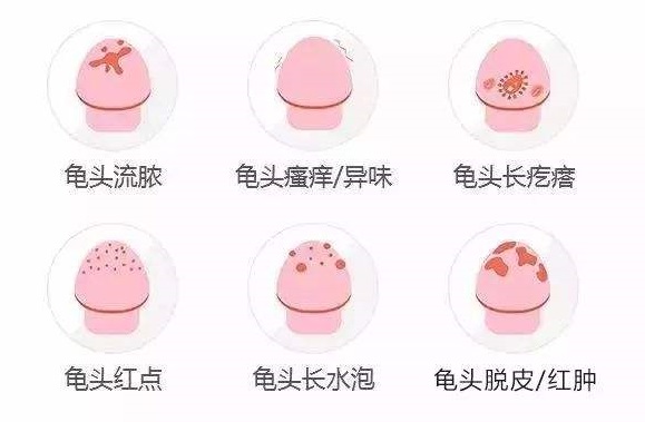 ��ͷ�׵�Σ��